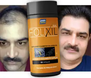 Seu Cabelo De Volta com Folixil